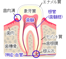 根管治療