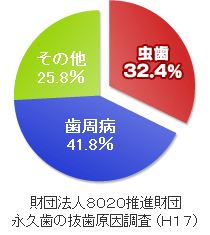 永久歯の抜歯原因