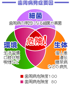 歯周病発症の原因