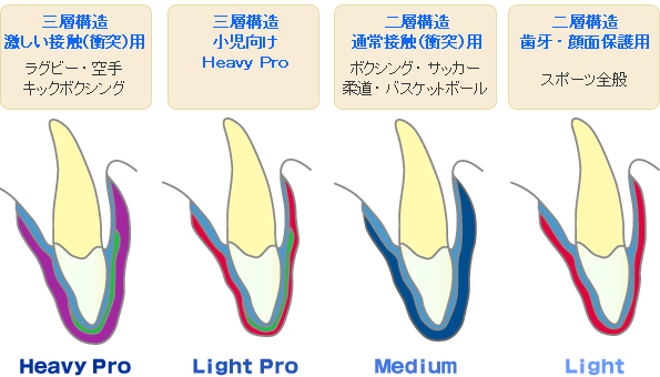 歯科医院でつくるマウスガードの特徴